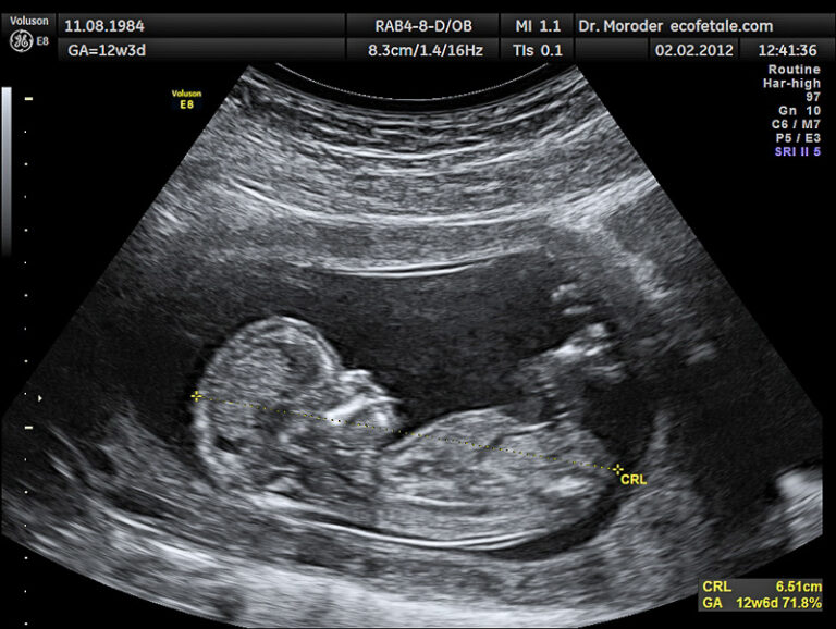 DIPLOMADO EN ECOGRAFÍA FETAL