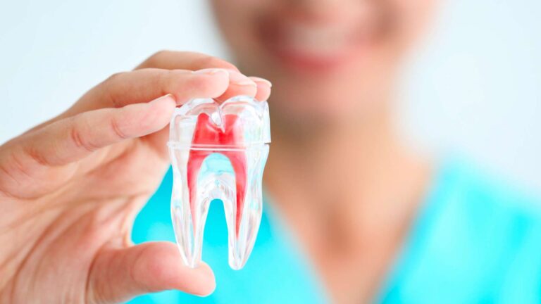 DIPLOMADO EN ENDODONCIA