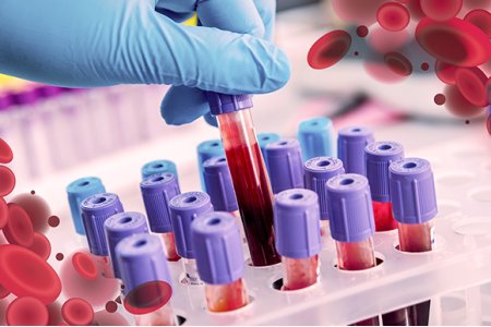 DIPLOMADO EN HEMATOLOGÍA Y HEMOSTASIA APLICADA AL LABORATORIO CLÍNICO