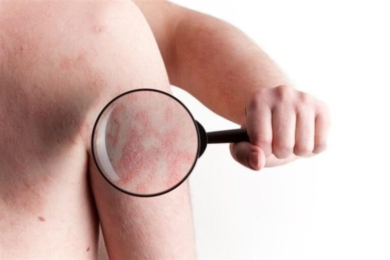 DIPLOMADO EN TRATAMIENTO DE LAS ENFERMEDADES DERMATOLÓGICAS